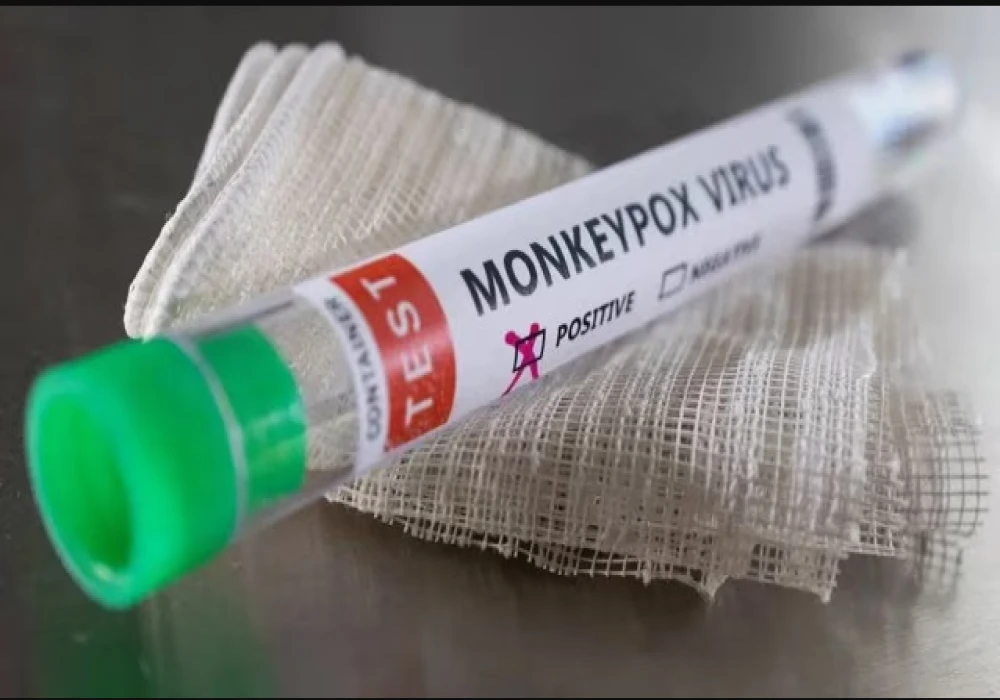 What is MonkeyPox Virus | Global Health Emergency | Symptoms | Prevention